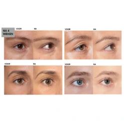 L'Oreal Lu0027Oréal Clinically Proven Wimperserum -Beauty Verkoop 994623 4